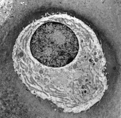 Chondrocyte showing organelles