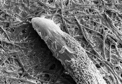 SEM Phytophthora spores on rye grass root