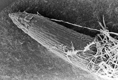 SEM Pythium spores and hyphae on root tip