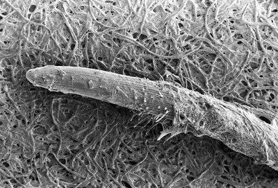 SEM Pythium spores and hyphae on root tip