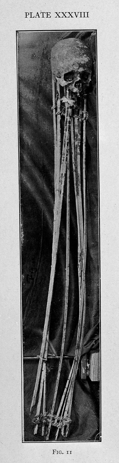 Egyptian mummy.