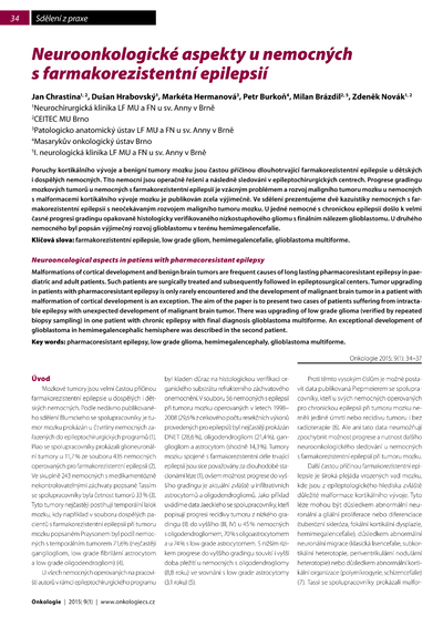 Neuroonkologické aspekty u nemocných s farmakorezistentní epilepsiíNeurooncological aspects in patiens with pharmacoresistant epilepsy